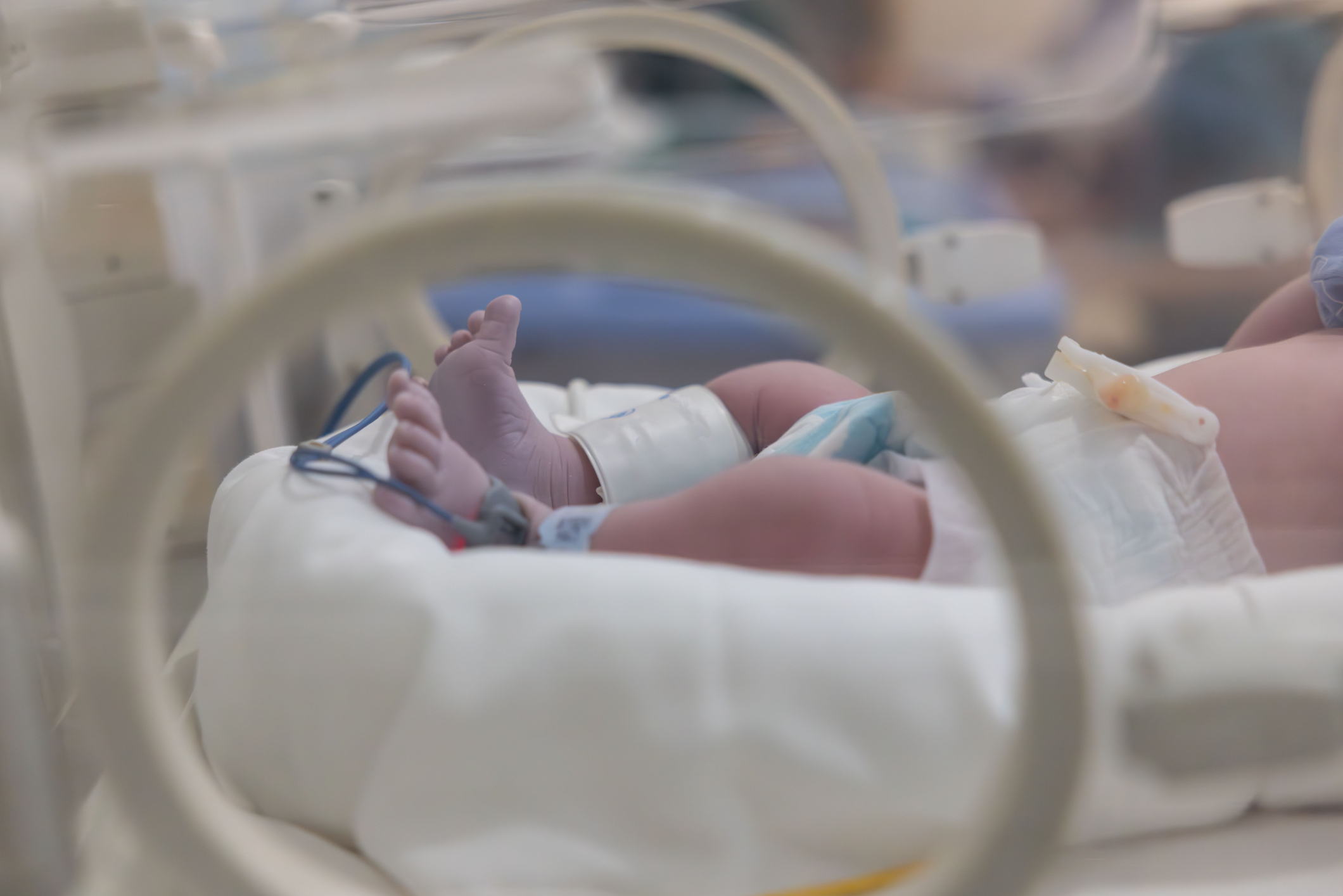 The Emotional Toll of the NICU: Supporting Parents After a Traumatic Start